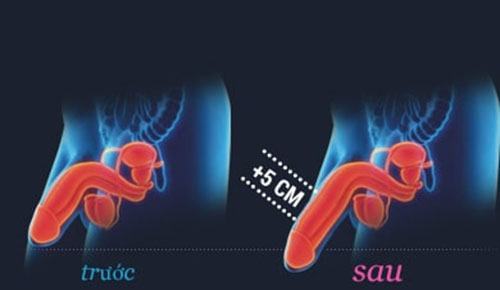 Tác dụng của gel maxisize