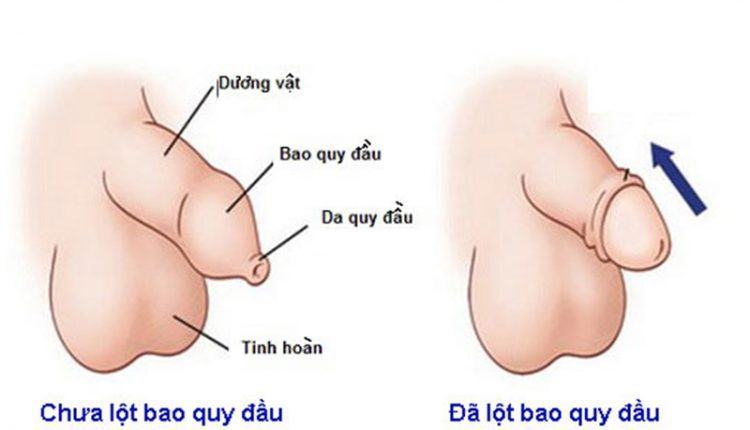 cách lột bao quy đầu dài tại nhà