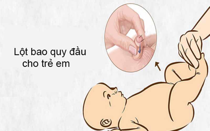 cách lột bao quy đầu dài trẻ em tại nhà