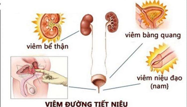 Viêm đường tiết niệu