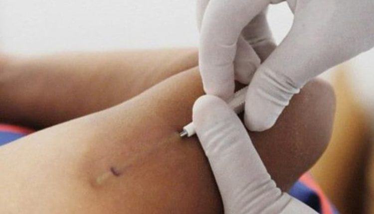 Que cấy tránh thai là gì