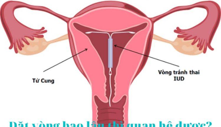Đặt vòng bao lâu thì quan hệ được?
